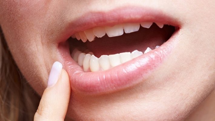 Eyüp Diş İmplant Tedavisi